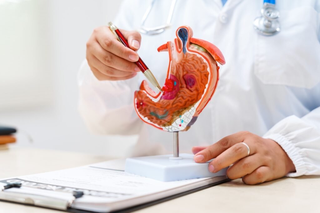 Modelo anatómico del estómago. Imagen ilustrativa suministrada por AstraZeneca.